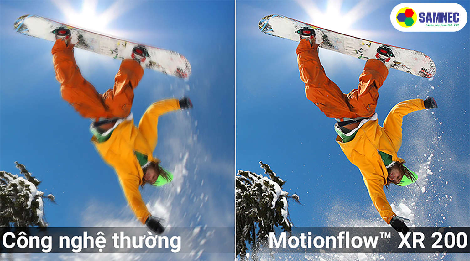 Motionflow™ XR 200