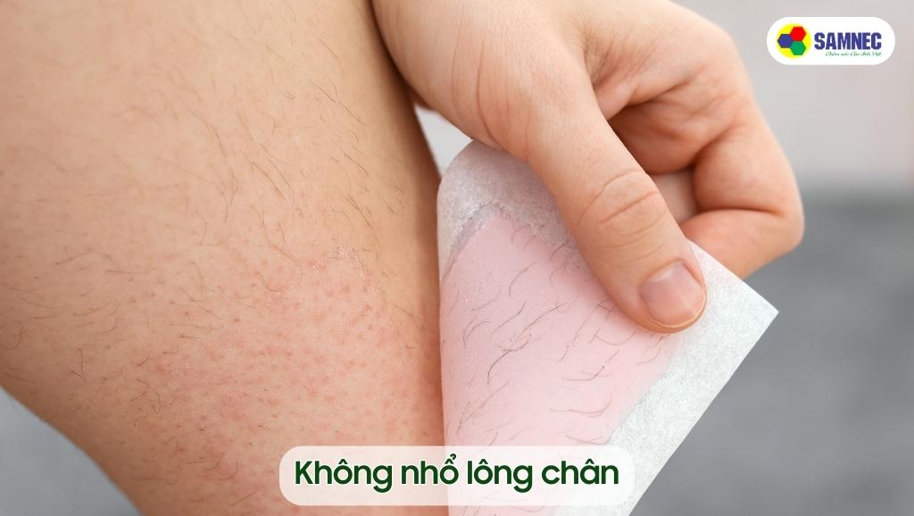 Không nhổ lông chân